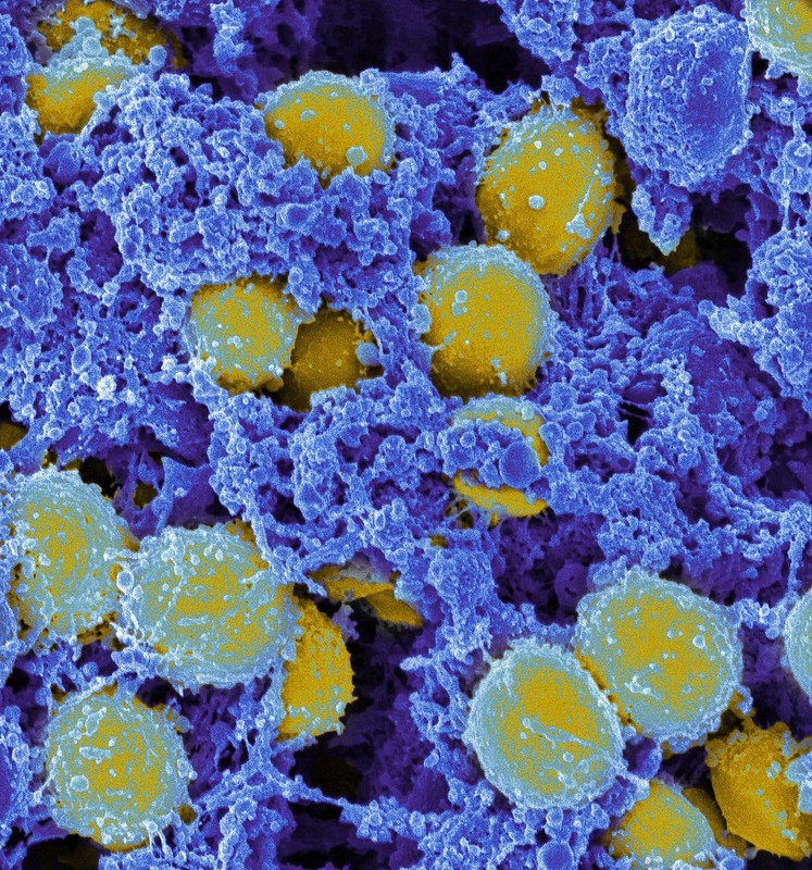 Staphylococcus Aures