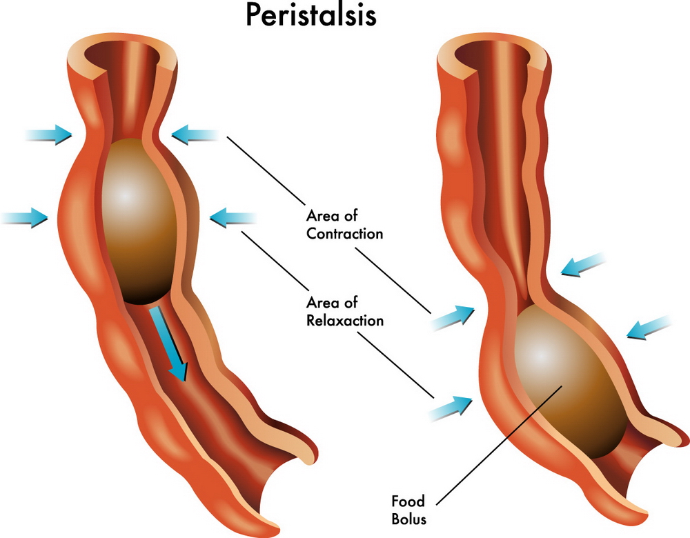 Sindrome dell'intestino irritabile