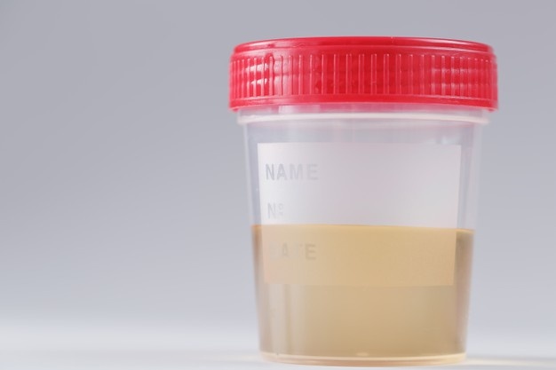 Contenitore Urine 