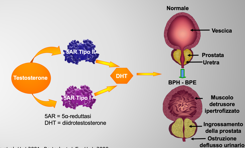 MEccanismo di crescita della Prostata Causata Dall' IPb